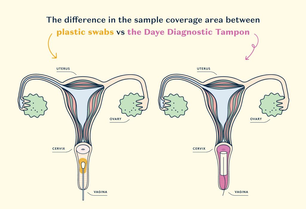 The dfference in sample coverage between a swab vs tampon